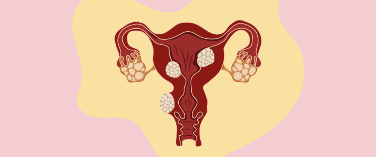 Endometrial Biopsy